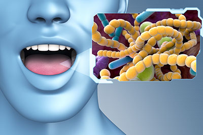 The image shows a 3D rendering of a human head with an open mouth and a visual representation of bacteria or viruses, which appear to be yellow and green, superimposed on the lower half of the face, suggesting a theme related to health, hygiene, or illness.