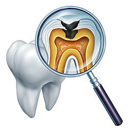 The image shows a magnified view of a tooth with an x-ray showing its internal structure, including the pulp chamber and root canals, under a microscope with a magnifying glass handle.