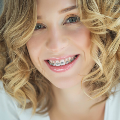 A smiling woman with braces and curly hair, wearing makeup and a white top.