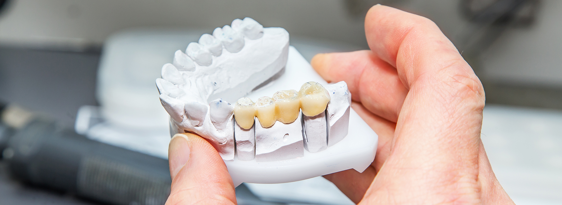 The image shows a person holding a 3D printed model of a human mouth with teeth, set against a blurred background with a focus on the object being held.