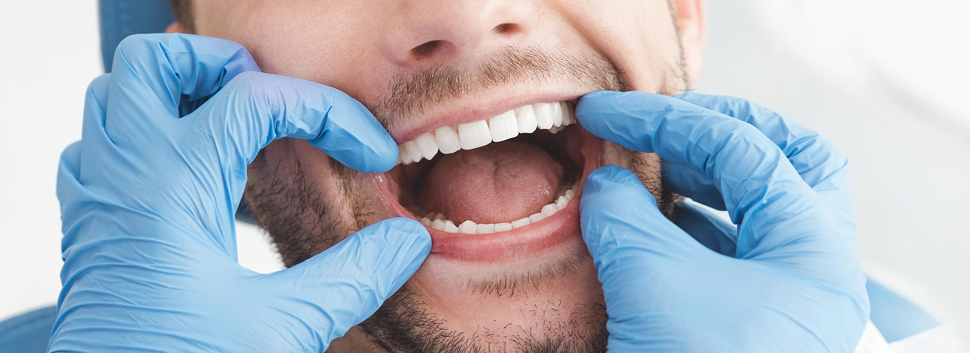 This is an image of a man with his mouth open, wearing medical gloves and a blue surgical mask, possibly in a dental or oral care setting.